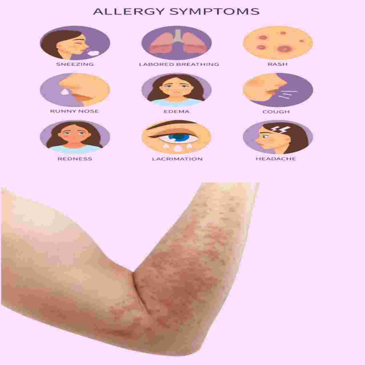 রক্তের এলার্জি দূর করার উপায়